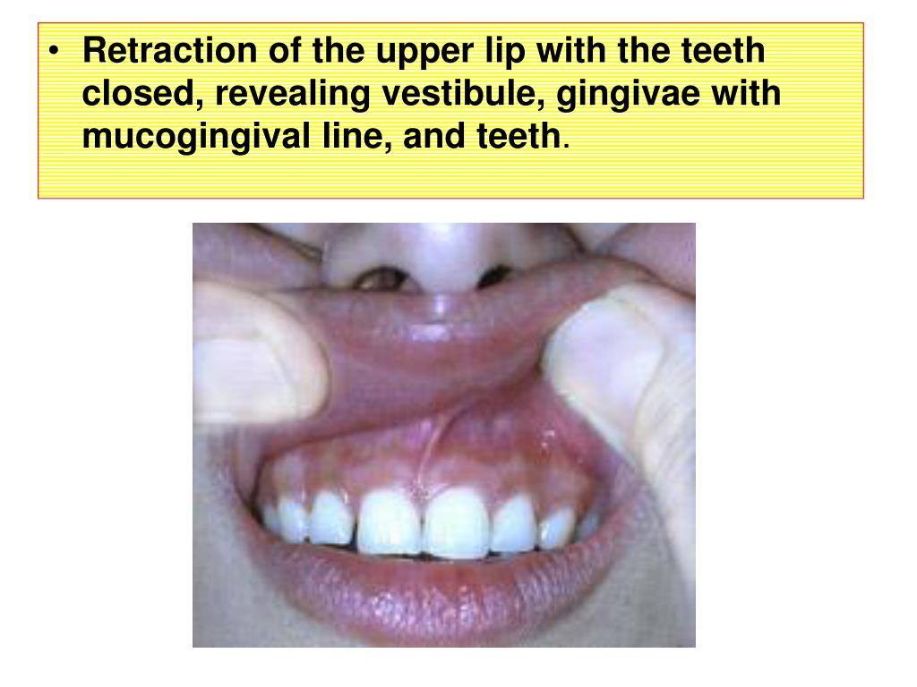PPT Oral cavity & Pharynx Trachea PowerPoint
