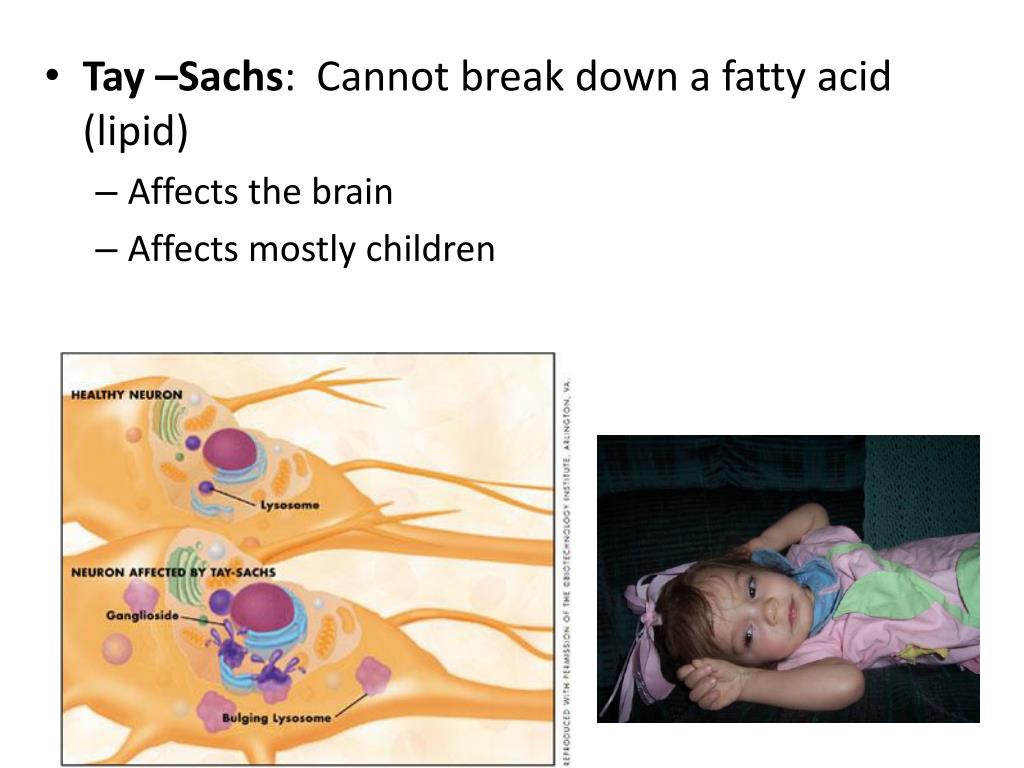 PPT Disorders, Karyotypes , & Pedigrees PowerPoint