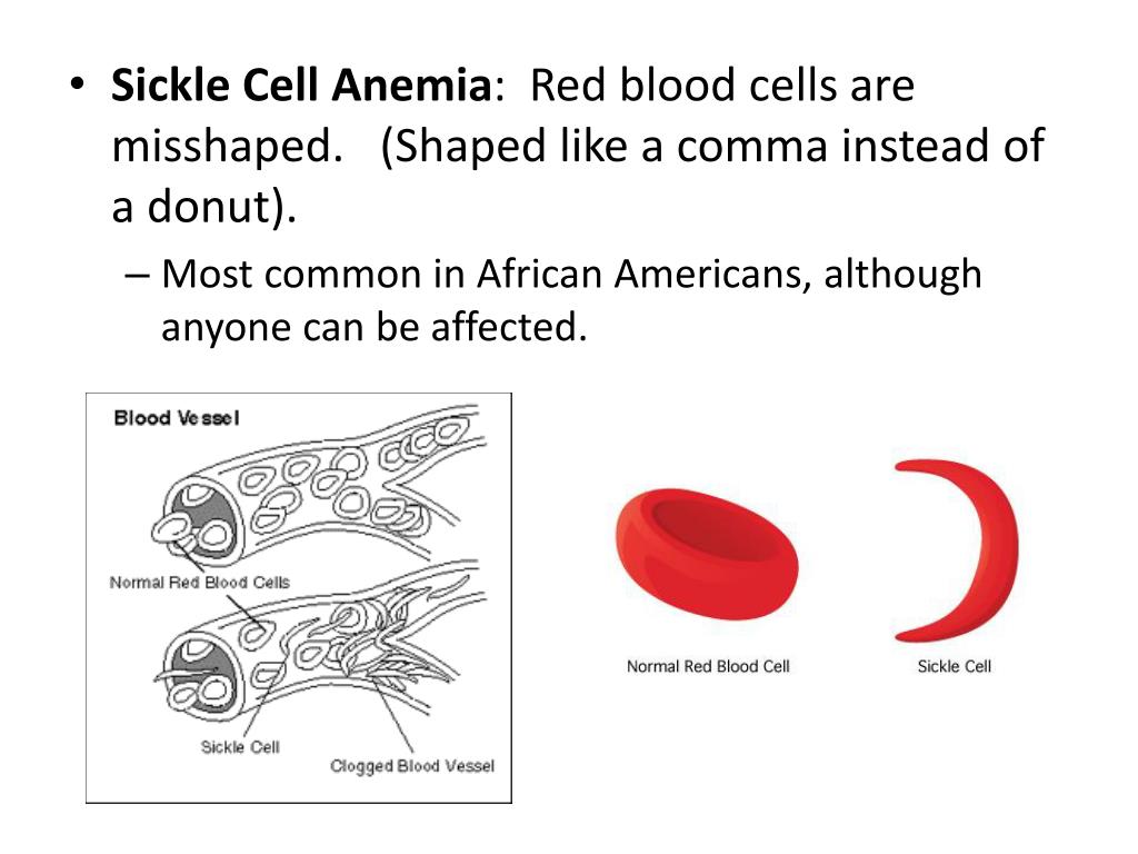 PPT Disorders, Karyotypes , & Pedigrees PowerPoint