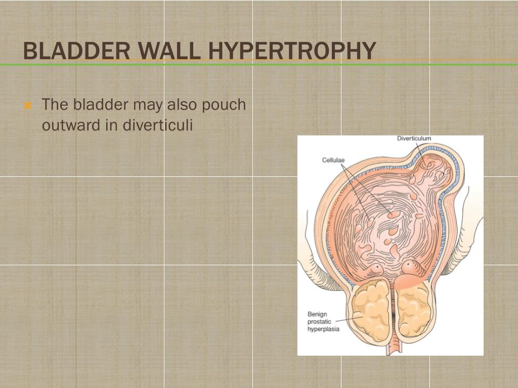 PPT Chapter 27 Disorders of the Bladder and Lower Urinary Tract