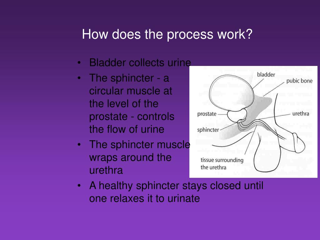PPT Incontinence and Prostate Cancer PowerPoint Presentation, free