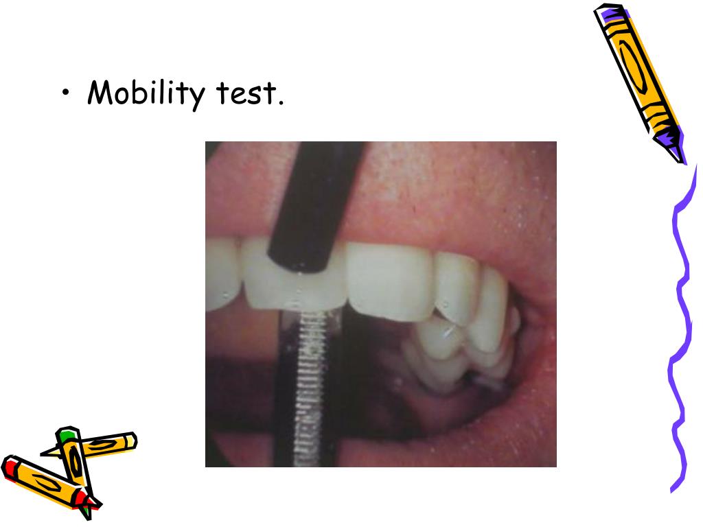 PPT Endodontic diagnosis and treatment planning PowerPoint