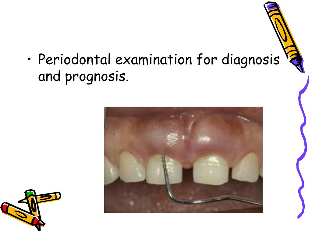 PPT Endodontic diagnosis and treatment planning PowerPoint
