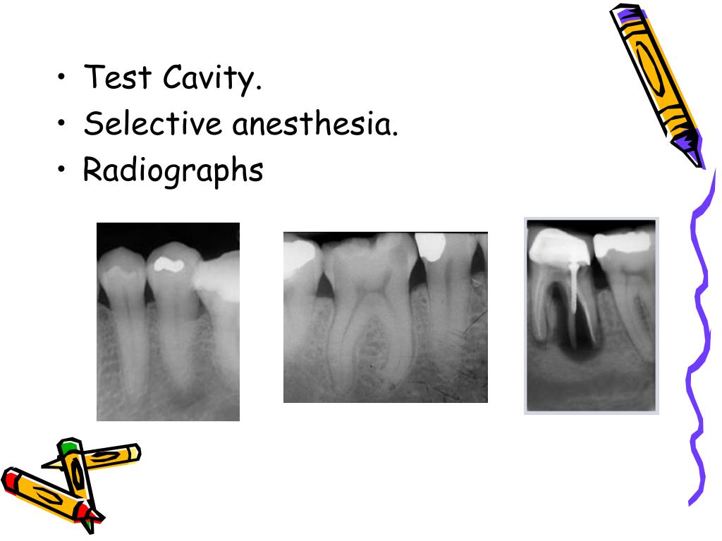 PPT Endodontic diagnosis and treatment planning PowerPoint