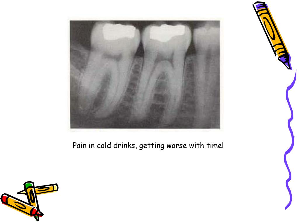 PPT Endodontic diagnosis and treatment planning PowerPoint