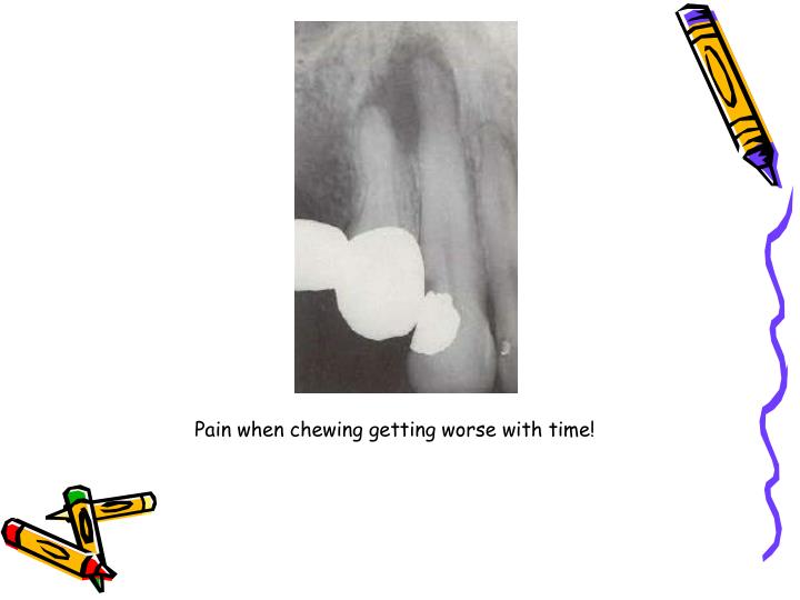 PPT Endodontic diagnosis and treatment planning PowerPoint