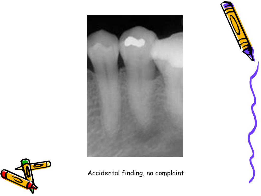 PPT Endodontic diagnosis and treatment planning PowerPoint
