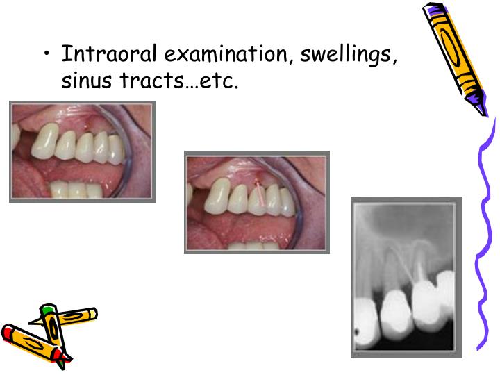 PPT Endodontic diagnosis and treatment planning PowerPoint