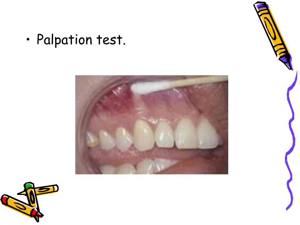 PPT Endodontic diagnosis and treatment planning PowerPoint