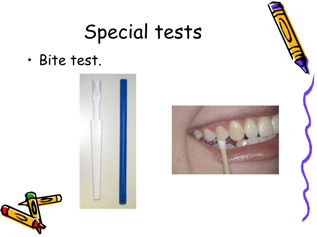 PPT Endodontic diagnosis and treatment planning PowerPoint