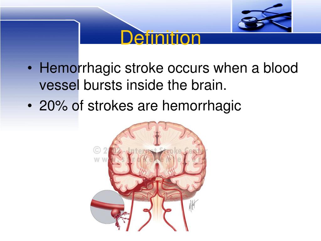PPT Hemorrhagic stroke PowerPoint Presentation, free download ID