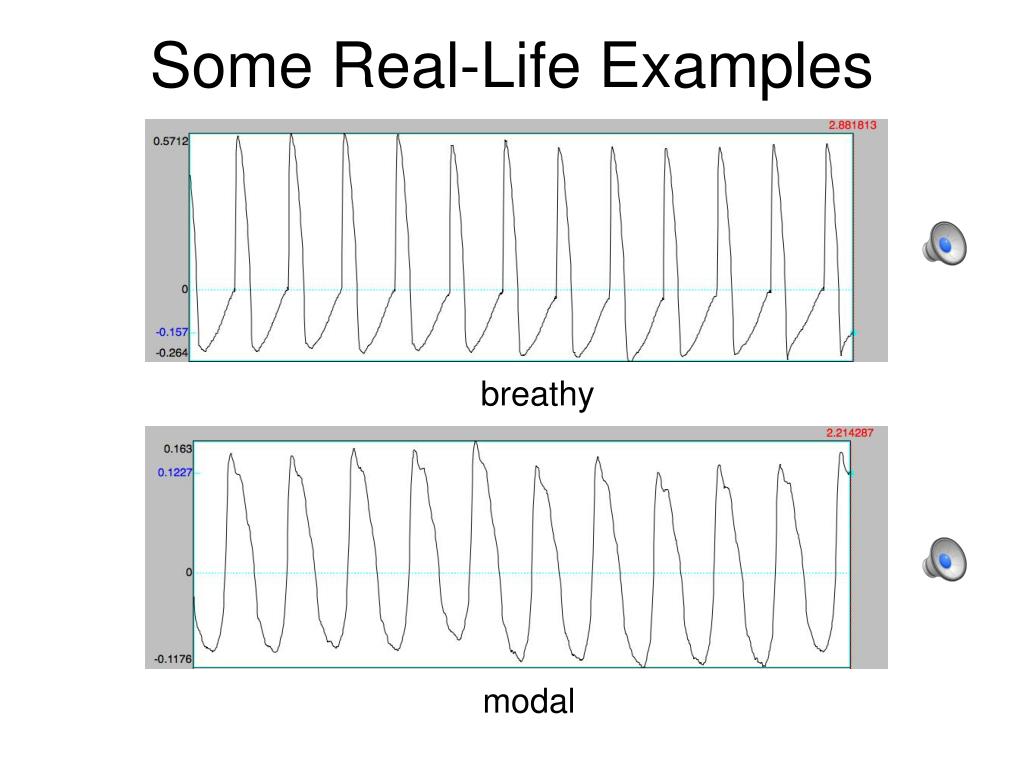 PPT Voice Quality + Spectral Analysis PowerPoint Presentation, free