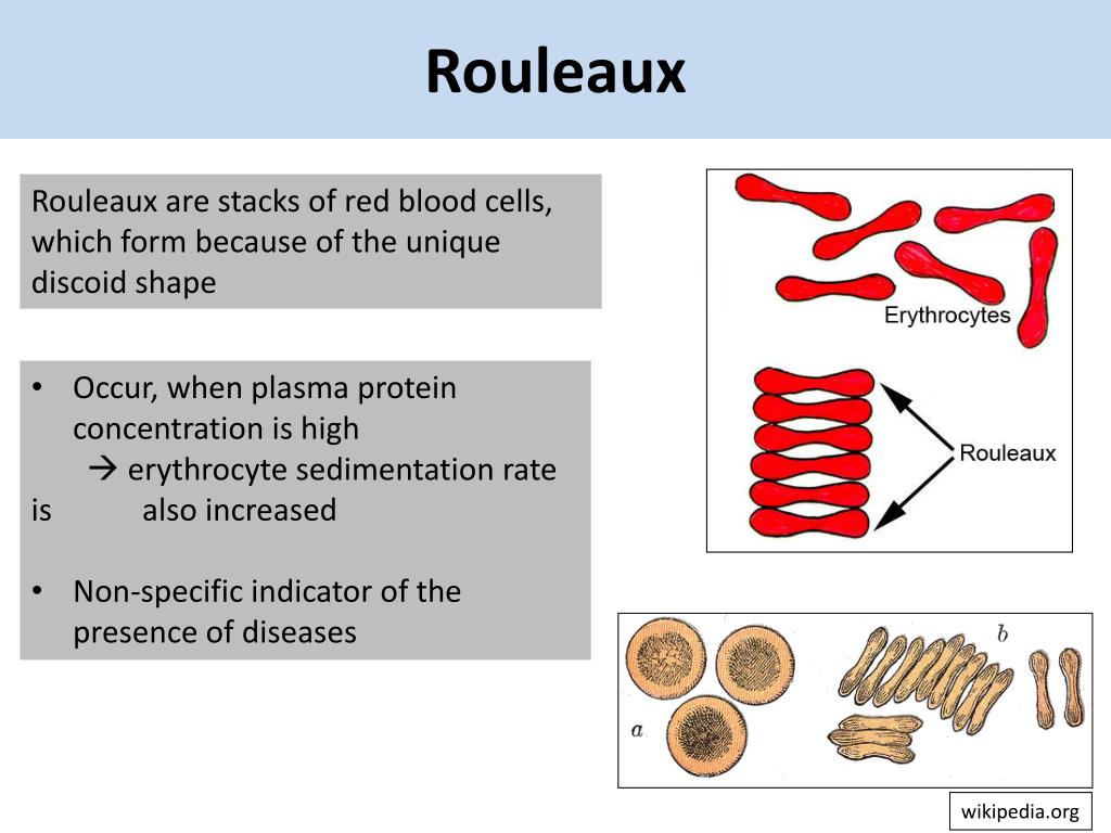 PPT Karl Landsteiner and the Discovery of Blood Groups PowerPoint