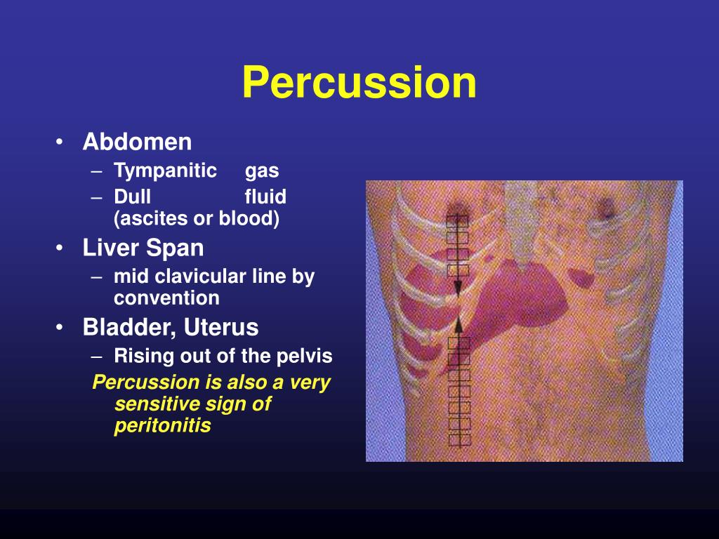 PPT THE ACUTE ABDOMEN PowerPoint Presentation, free download ID3139688