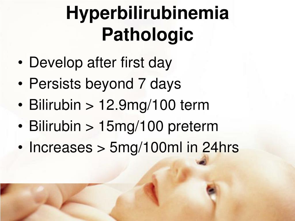 PPT High Risk Newborn PowerPoint Presentation, free