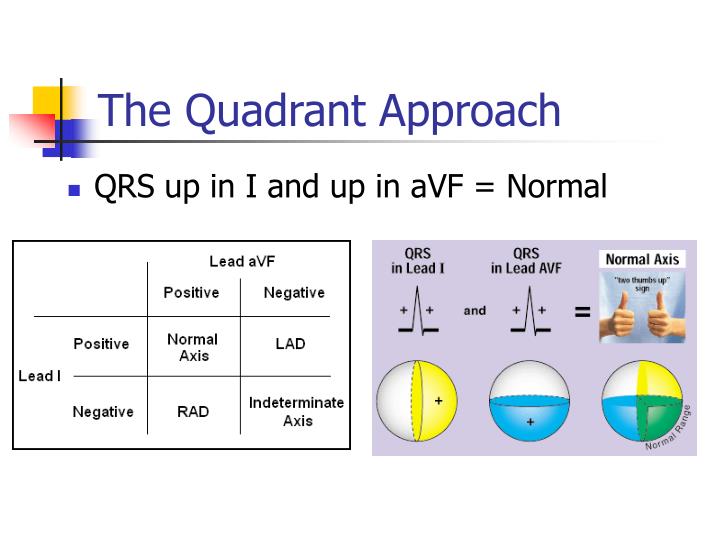 PPT EKG Interpretation PowerPoint Presentation ID3221637