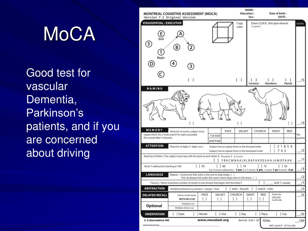 Are There Tests For Dementia geoidesign