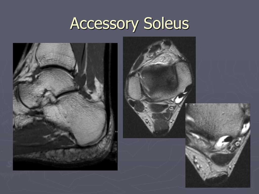 PPT Musculoskeletal MRI PowerPoint Presentation, free download ID