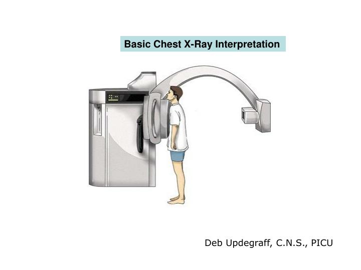 PPT Basic Chest XRay Interpretation PowerPoint Presentation, free