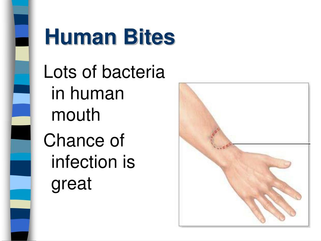 PPT First Aid PowerPoint Presentation, free download ID3277367