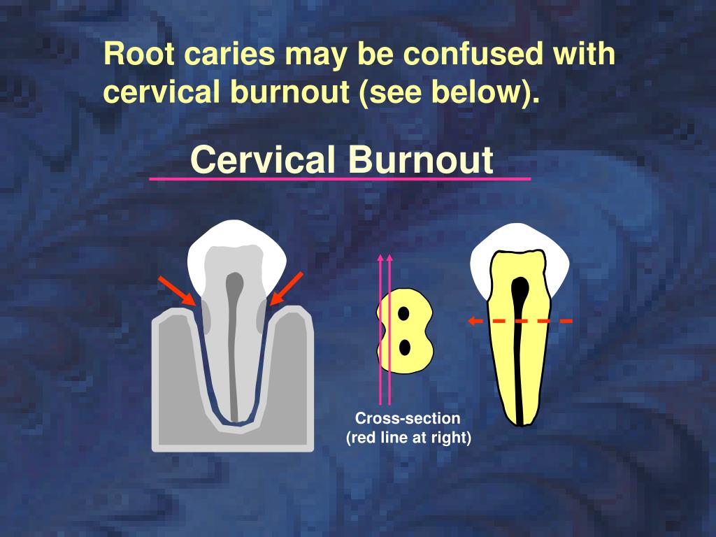 PPT Interpreting Radiographs PowerPoint Presentation, free download