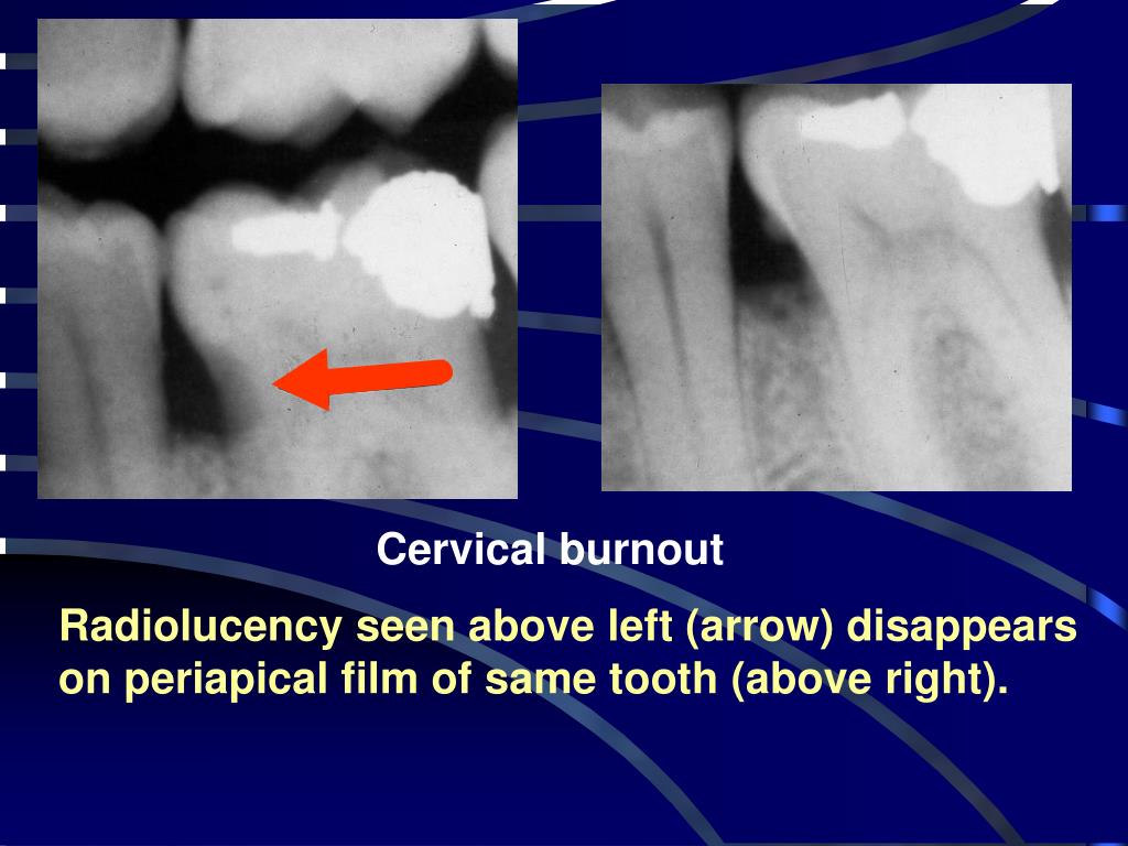 PPT Interpreting Radiographs PowerPoint Presentation, free download