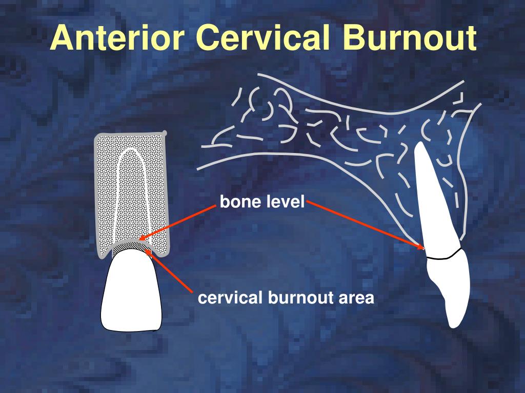 PPT Interpreting Radiographs PowerPoint Presentation, free download