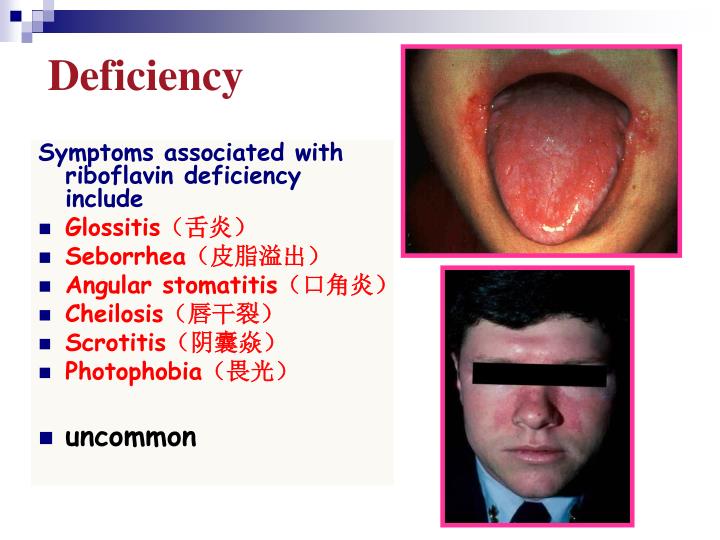 PPT Lecture 6 Vitamins and Coenzymes PowerPoint Presentation ID3300492