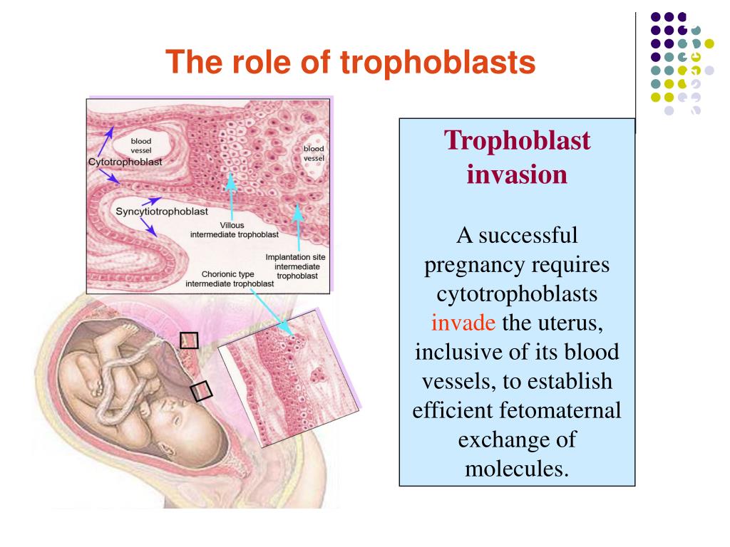 PPT Gestational Trophoblastic Disease (GTD) PowerPoint Presentation