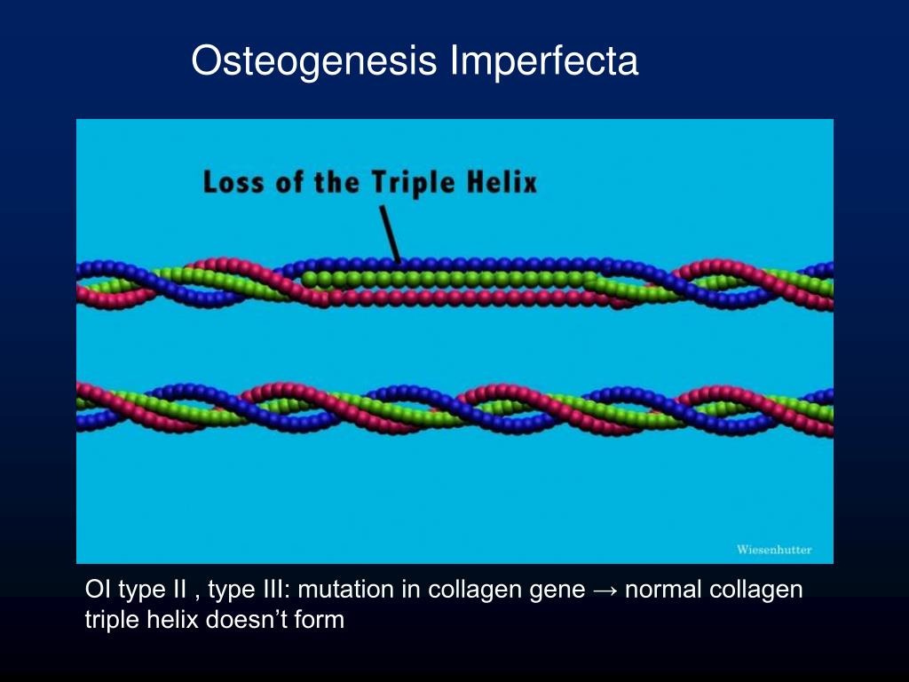 PPT Collagen Disorders Osteogenesis Imperfecta Ehlers Danlos