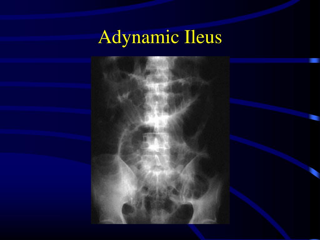 PPT DEFINITION PowerPoint Presentation, free download ID3343530