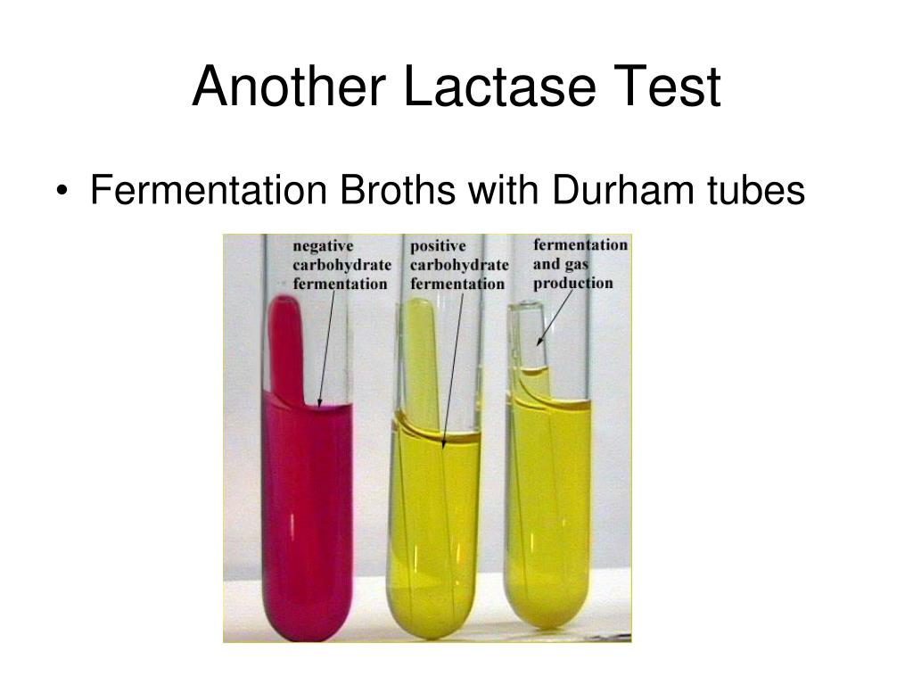 PPT How to ID an Unknown Organism Gram Negative Rods PowerPoint