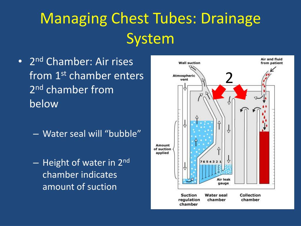 Water Seal Chamber Water Ionizer
