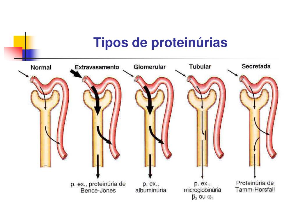 PPT Avaliação da Função Renal PowerPoint Presentation, free download
