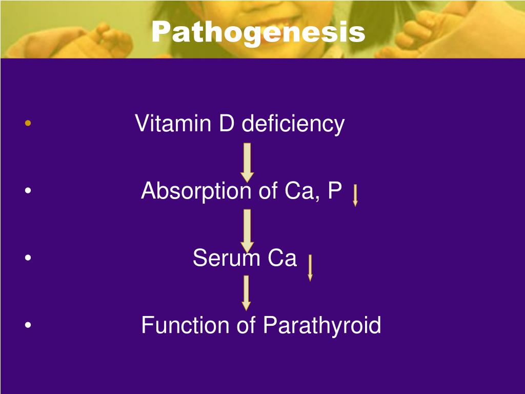 PPT Rickets Etiology, pathogenesis, clinical features, diagnostics