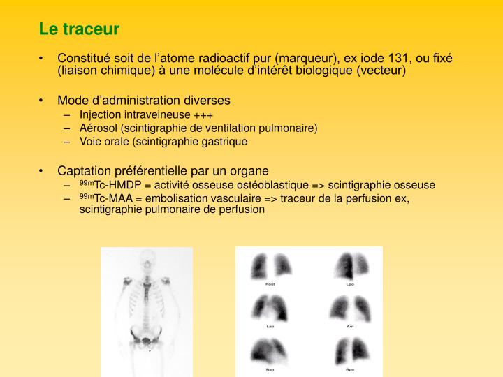PPT Imagerie scintigraphique par gammacaméras PowerPoint Presentation ID3380287