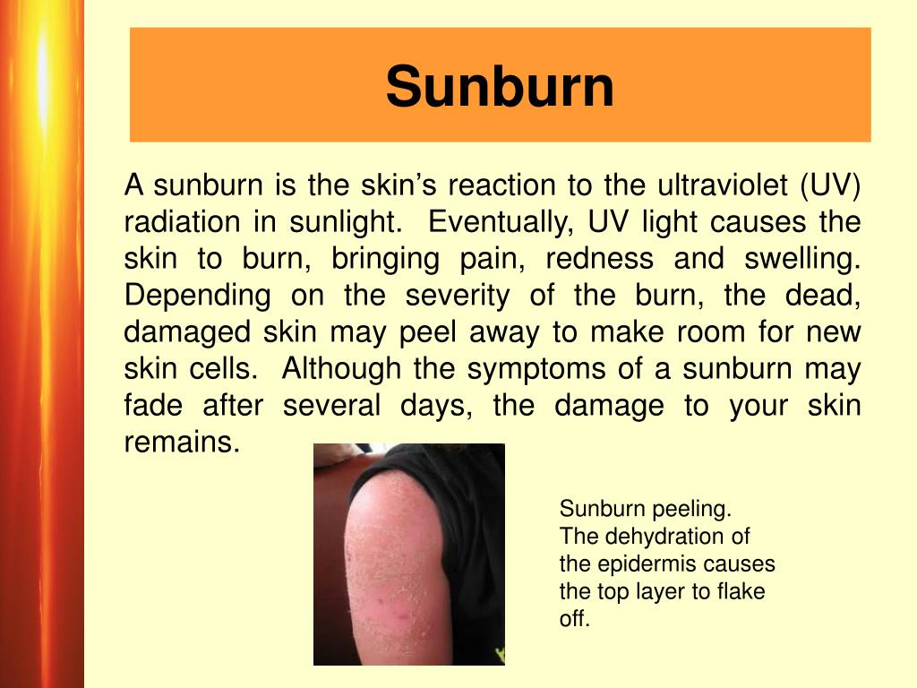 PPT SUN SAFETY EXPOSURE, DAMAGE, AND PREVENTION PowerPoint