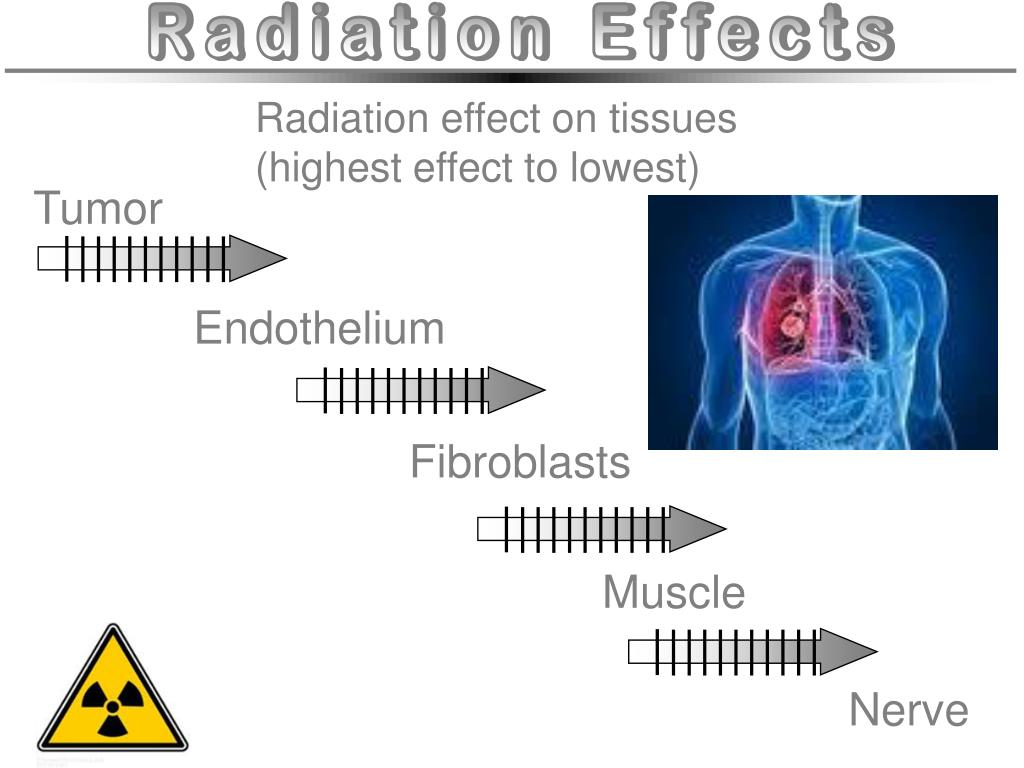 PPT Hyperbaric Oxygen Therapy for Radiation Injuries PowerPoint