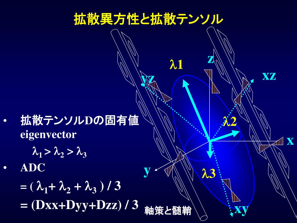 PPT 画像法の原理 (6) 拡散画像 3 PowerPoint Presentation, free