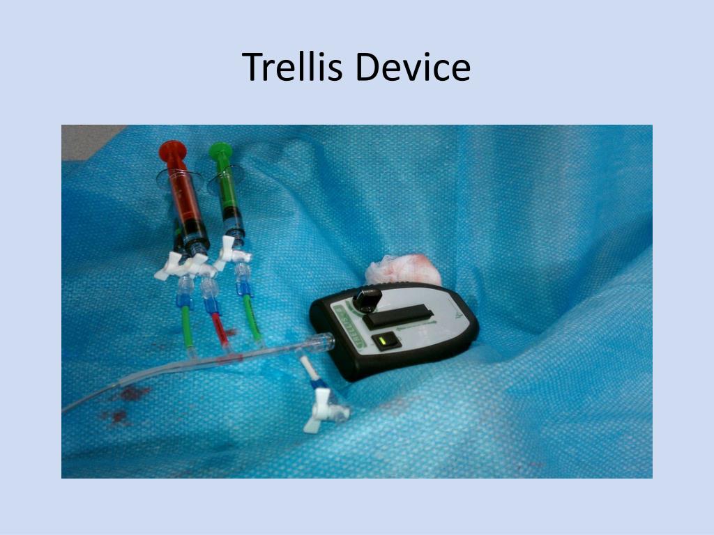 PPT Endovascular Treatment for Patients with Deep Vein Thrombosis