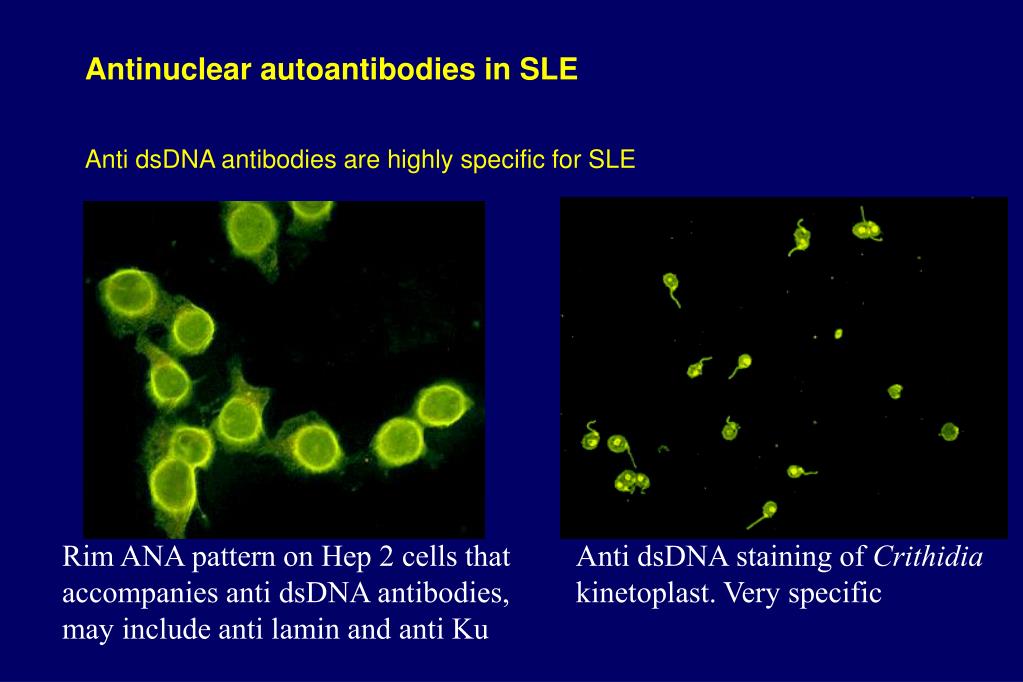 PPT Systemic Lupus Erythematosus (SLE) PowerPoint Presentation, free download ID3465274