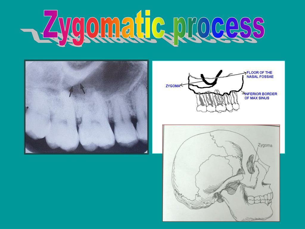 PPT NORMAL ANATOMICAL RADIOGRAPHIC LANDMARKS PowerPoint Presentation