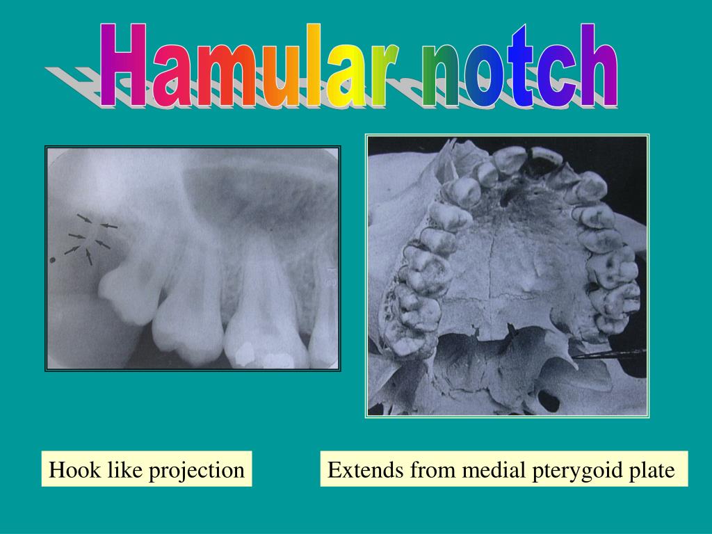 PPT NORMAL ANATOMICAL RADIOGRAPHIC LANDMARKS PowerPoint Presentation