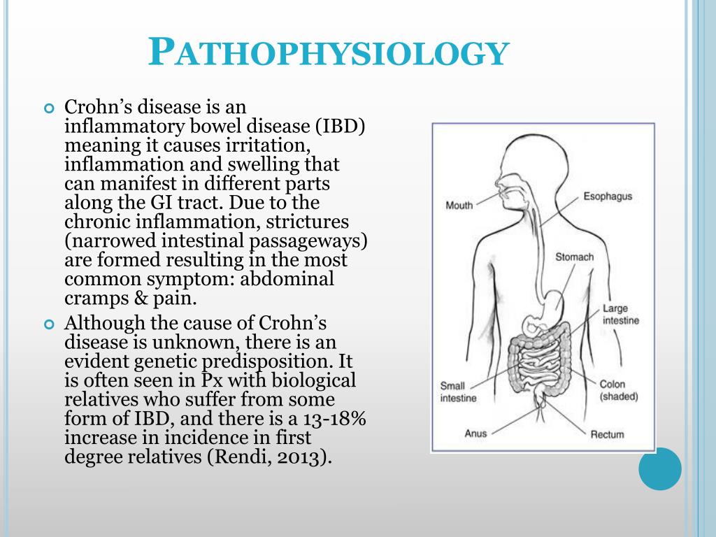 PPT Crohn’s disease PowerPoint Presentation, free download ID3480640