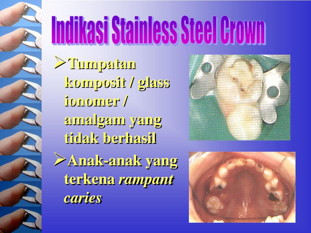 PPT Stainless Steel Crown PowerPoint Presentation, free download ID