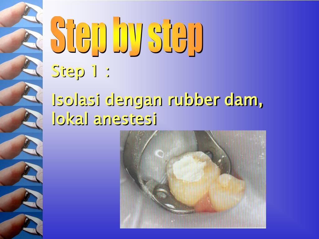 PPT Stainless Steel Crown PowerPoint Presentation, free download ID