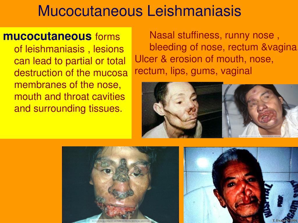 PPT Haemoflagellates PowerPoint Presentation, free download ID3501053