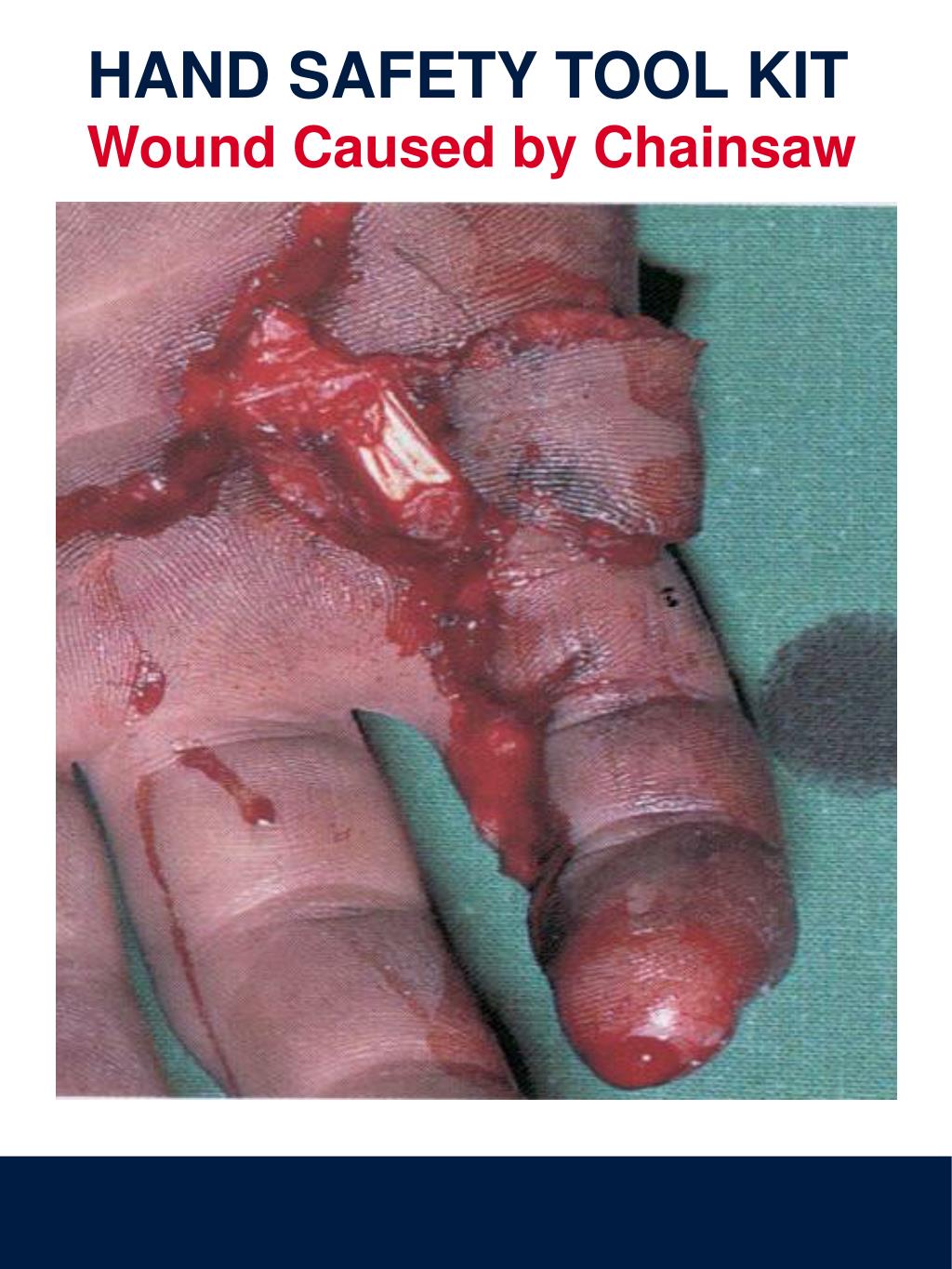 PPT Five Toolbox Topics on Hand Safety PowerPoint Presentation, free