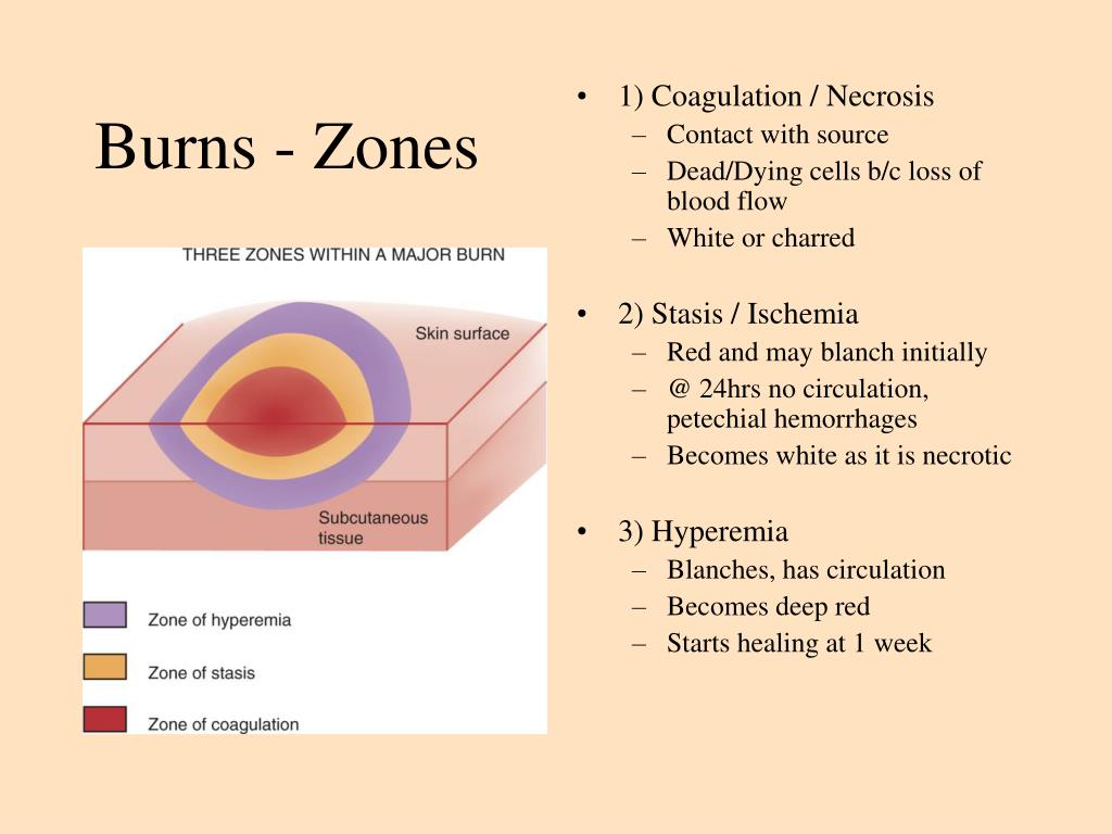 PPT Wound Management PowerPoint Presentation, free download ID3530101