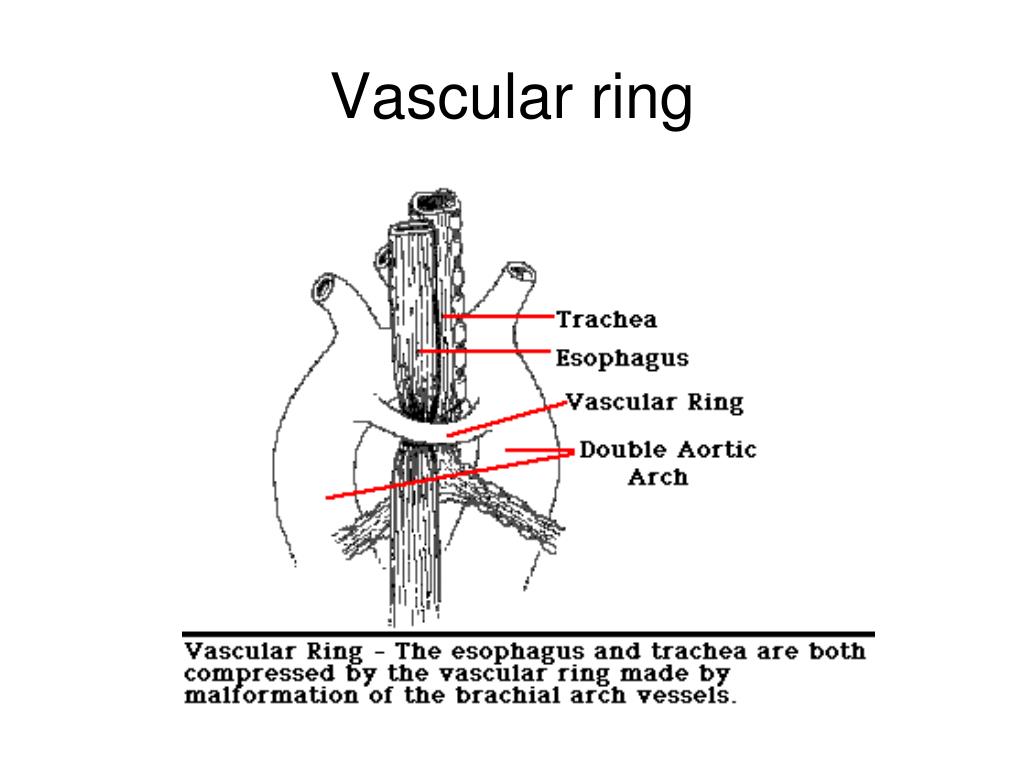 PPT Congenital Heart Defects Functional Overview PowerPoint Presentation ID3542591